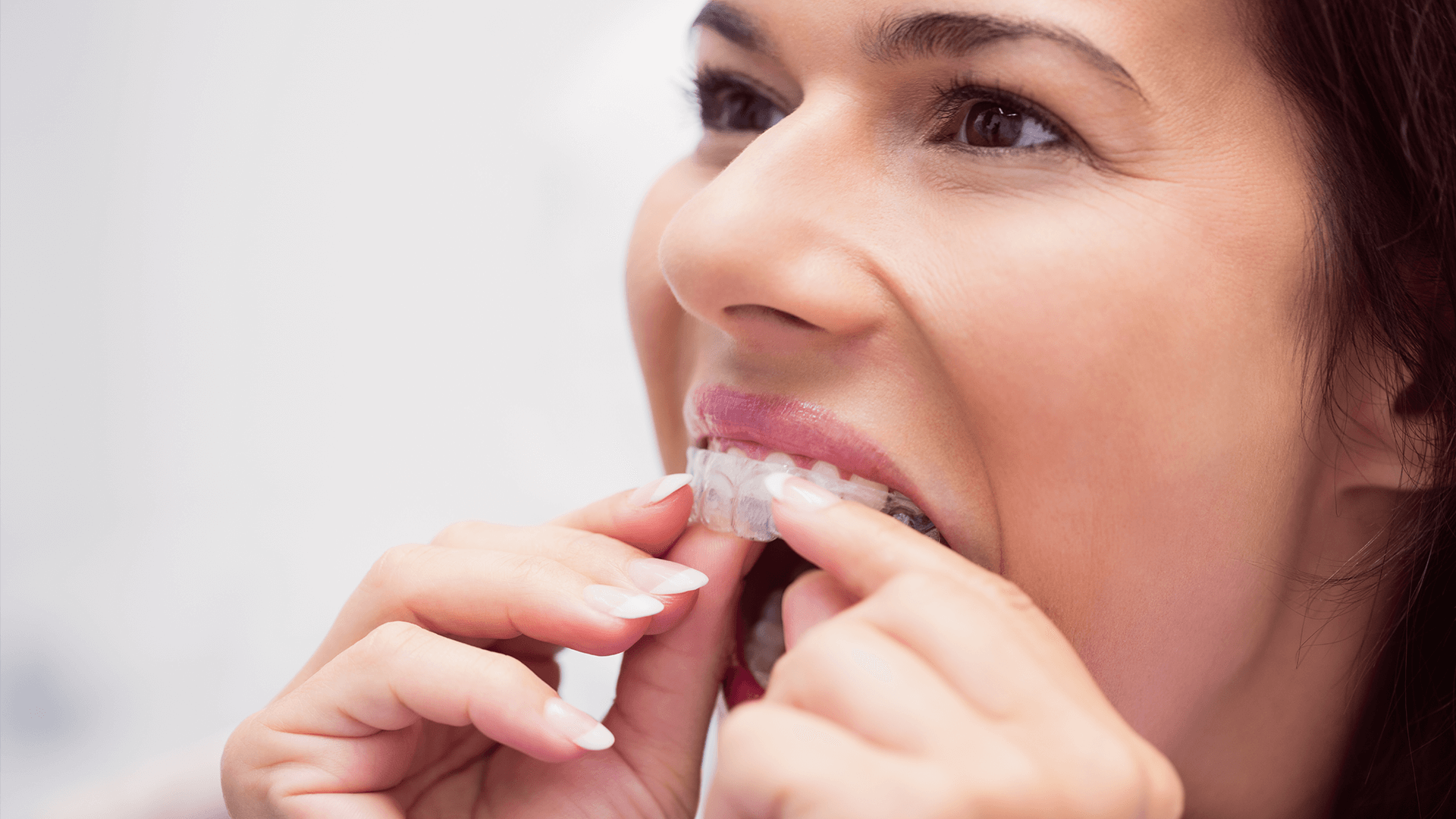 Woman putting on invisalign.