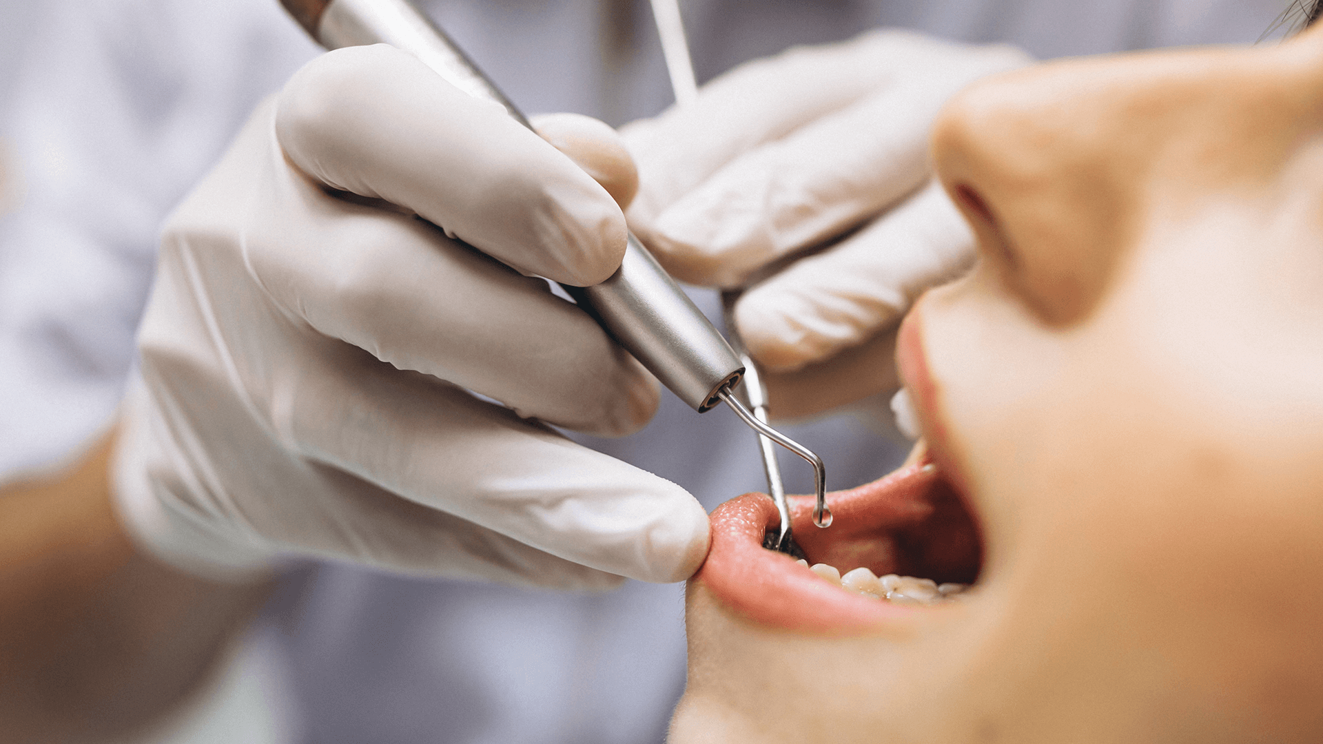 Dentist examining a client's mouth.