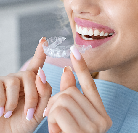 Woman about to insert a clear aligner into her mouth.